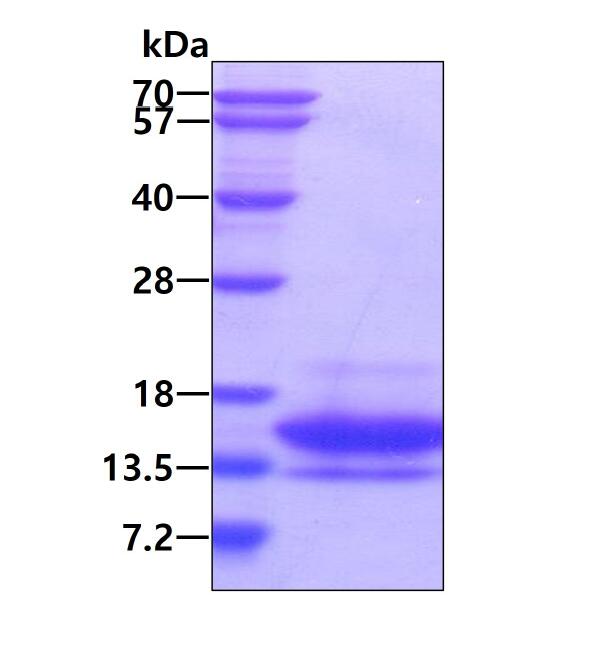 3 μg by SDS-PAGE under reducing condition and visualized by coomassie blue stain.